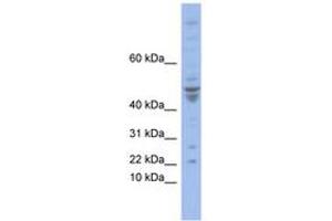 Image no. 1 for anti-Polymerase (DNA-Directed), epsilon 4 (p12 Subunit) (POLE4) (N-Term) antibody (ABIN6742852) (POLE4 antibody  (N-Term))