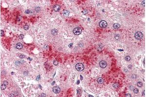 ABIN185639 (4µg/ml) staining of paraffin embedded Human Liver. (Leptin Receptor antibody  (Internal Region))