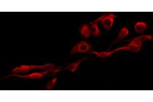 Immunofluorescence (fixed cells) (IF/ICC) image for anti-Integrin beta 3 (ITGB3) (pTyr785) antibody (ABIN6256804)