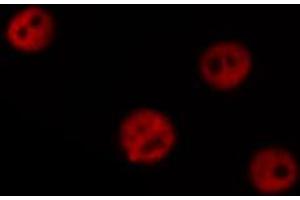 ABIN6266664 staining Hela by IF/ICC. (TOP2B antibody  (N-Term))