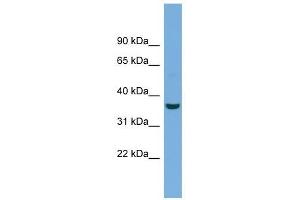 Crystallin Mu antibody used at 1 ug/ml to detect target protein. (CRYM antibody  (N-Term))