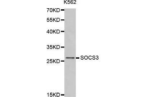 Western blot analysis of extracts of K562 cells tissue, using SOCS3 antibody. (SOCS3 antibody  (C-Term))