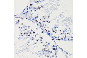 Immunohistochemistry (IHC) image for anti-Histone Deacetylase 1 (HDAC1) antibody (ABIN7267707)