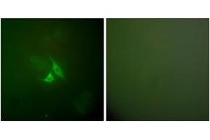 Immunofluorescence analysis of A549 cells, using Cox2 Antibody. (COX2 antibody  (AA 555-604))