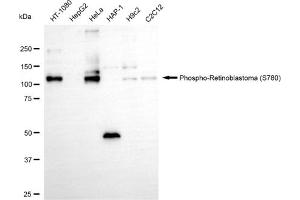 Western blotting analysis using phospho-retinoblastoma (S780) antibody (ABIN7800183).