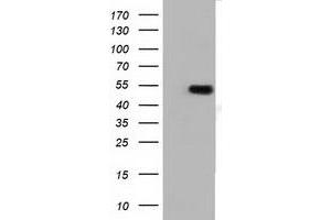 Western Blotting (WB) image for anti-Tubulin, alpha 3e (TUBA3E) antibody (ABIN1501557) (TUBA3E antibody)