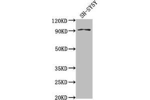 Western Blot Positive WB detected in: SH-SY5Y whole cell lysate All lanes: GPLD1 antibody at 1:2000 Secondary Goat polyclonal to rabbit IgG at 1/50000 dilution Predicted band size: 93, 20 kDa Observed band size: 93 kDa (GPLD1 antibody  (AA 310-565))