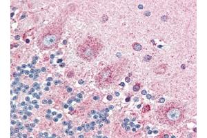 Immunohistochemistry (Paraffin-embedded Sections) (IHC (p)) image for anti-Prostaglandin D2 Receptor 2 (PTGDR2) (N-Term) antibody (ABIN615056)