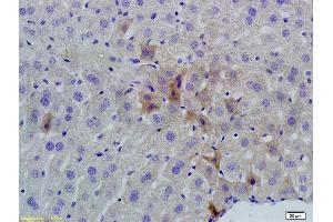 Formalin-fixed and paraffin embedded mouse liver labeled with Rabbit Anti phospho-GCN2 (Thr667) Polyclonal Antibody, Unconjugated (ABIN684958) at 1:200 followed by conjugation to the secondary antibody and DAB staining (GCN2 antibody  (pThr667))