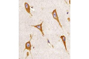 Paraformaldehyde-fixed, paraffin embedded human brain tissue, Antigen retrieval by boiling in sodium citrate buffer (pH6. (BCAP31 antibody)