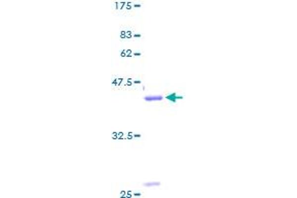 Gastrin-Releasing Peptide Protein (GRP) (AA 1-148) (GST tag)