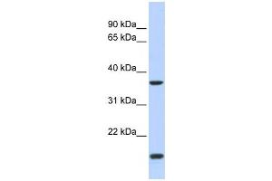 Western Blotting (WB) image for anti-Zic Family Member 4 (ZIC4) antibody (ABIN2458430)