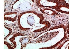 Immunohistochemistry (IHC) image for anti-Inhibitor of kappa Light Polypeptide Gene Enhancer in B-Cells, Kinase gamma (IKBKG) (AA 60-120) antibody (ABIN7189515)