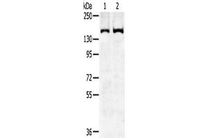 Gel: 6 % SDS-PAGE,Lysate: 40 μg,Lane 1-2: Hela cells, K562 cells,Primary antibody: ABIN7192310(SENP6 Antibody) at dilution 1/450 dilution,Secondary antibody: Goat anti rabbit IgG at 1/8000 dilution,Exposure time: 5 minutes (SENP6 antibody)