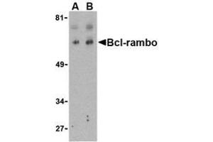 Western blot analysis of Bcl-rambo in K562 cell lysate with AP30131PU-N Bcl-rambo antibody at (A) 2 and (B) 4 μg/ml. (BCL2L13 antibody  (Intermediate Domain))