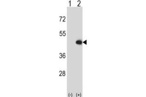 Western Blotting (WB) image for anti-Creatine Kinase, Mitochondrial 2 (Sarcomeric) (CKMT2) antibody (ABIN3002972) (CKMT2 antibody)