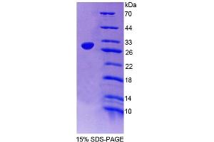 SDS-PAGE (SDS) image for Nuclear RNA Export Factor 1 (NXF1) (AA 2-197) protein (His tag) (ABIN4989066) (NXF1 Protein (AA 2-197) (His tag))