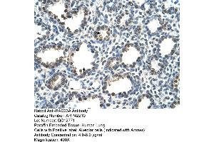 Rabbit Anti-RAD23A Antibody  Paraffin Embedded Tissue: Human Lung Cellular Data: Alveolar cells Antibody Concentration: 4.