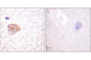 Immunohistochemistry (IHC) image for anti-DEAD (Asp-Glu-Ala-Asp) Box Polypeptide 3, X-Linked (DDX3X) (AA 466-515) antibody (ABIN2888820) (DDX3X antibody  (AA 466-515))