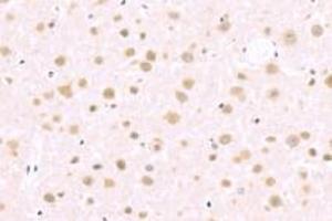 Immunohistochemistry analysis of paraffin-embedded rat cerebral infarction using BAAT1 (ABIN7073502) at dilution of 1: 1000