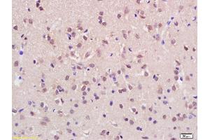 Formalin-fixed and paraffin embedded rat brain labeled with Rabbit Anti KMT2H/ASH1L Polyclonal Antibody, Unconjugated (ABIN1387873) at 1:200 followed by conjugation to the secondary antibody and DAB staining