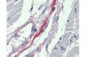 DDAH2 antibody was used for immunohistochemistry at a concentration of 4-8 ug/ml. (DDAH2 antibody  (N-Term))