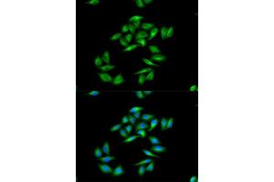 Immunofluorescence analysis of A-549 cells using CPT1A antibody. (CPT1A antibody  (AA 497-756))