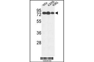 Western blot analysis of GUSB Antibody in WiDr, A2058, K562 cell line lysates (35ug/lane) (Glucuronidase beta antibody  (AA 335-362))