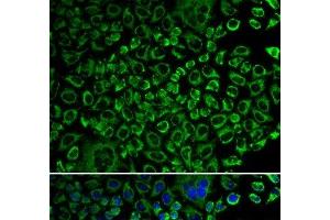 Immunofluorescence analysis of A549 cells using F10 Polyclonal Antibody (Coagulation Factor X antibody)