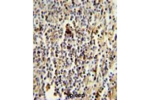 Immunohistochemistry (Paraffin-embedded Sections) (IHC (p)) image for anti-CD1e (CD1e) (AA 274-304), (Middle Region) antibody (ABIN951216)