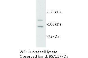 Image no. 1 for anti-Mast/stem Cell Growth Factor Receptor (KIT) antibody (ABIN1112872) (KIT antibody)