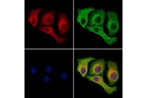 ABIN7094426 and ABIN7098473 staining Hela cells by IF/ICC. (COPB1 antibody  (Internal Region))