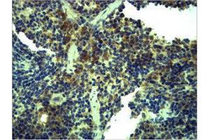 Immunohistochemistry (IHC) image for anti-Toll-Like Receptor 1 (TLR1) antibody (ABIN3181539) (TLR1 antibody)