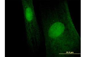 Immunofluorescence of purified MaxPab antibody to MAGEB6 on Hs 181. (MAGEB6 antibody  (AA 1-407))