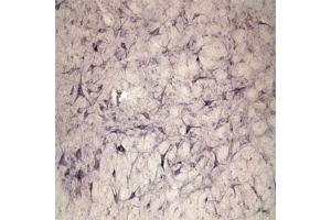 IHC on rat spinal cord using Rabbit antibody to extracellular, N-terminal part of Sortilin (Neurotensin receptor 3, NTR3, Sort1): IgG  at a concentration of 10 µg/ml. (Sortilin 1 antibody)