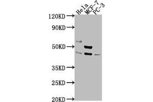 Western Blot Positive WB detected in: Hela whole cell lysate, MCF-7 whole cell lysate, PC-3 whole cell lysate All lanes: POU4F1 antibody at 1:2000 Secondary Goat polyclonal to rabbit IgG at 1/50000 dilution Predicted band size: 43, 34 kDa Observed band size: 43 kDa (POU4F1 antibody  (AA 258-419))