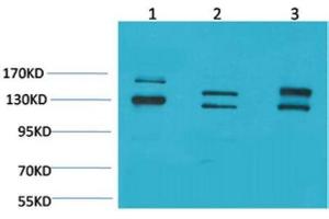 Western Blot (WB) analysis of 1) 293T, 2) Mouse Brain Tissue, 3) Rat Brain Tissue with BAI1 Rabbit Polyclonal Antibody diluted at 1:2000. (BAI1 antibody)