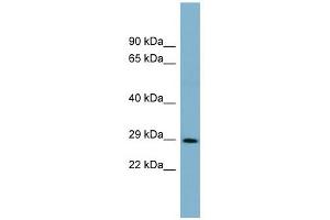 DCUN1D1 antibody used at 1 ug/ml to detect target protein. (DCUN1D1 antibody)
