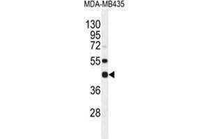 WDR51B Antibody (C-term) western blot analysis in MDA-MB435 cell line lysates (35 µg/lane). (POC1B antibody  (C-Term))