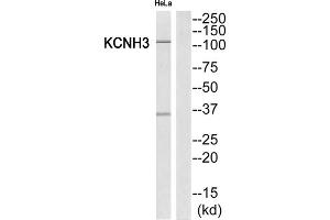 Western Blotting (WB) image for anti-Potassium Voltage-Gated Channel, Subfamily H (Eag-Related), Member 3 (Kcnh3) (Internal Region) antibody (ABIN1851848) (KCNH3 antibody  (Internal Region))