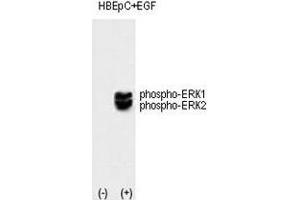Western blot analysis of phospho-ERK1/2 antibody and HBEpC cell lysate, noninduced (lane 1) or induced with the EGF (lane 2). (ERK1/2 antibody  (pThr202, pTyr204))