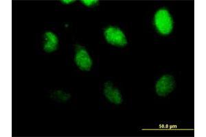 Immunofluorescence of purified MaxPab antibody to CSPG6 on HeLa cell. (SMC3 antibody  (AA 1-1217))