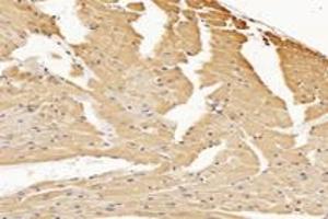 Immunohistochemistry analysis of paraffin-embedded mouse heart using,RHOBTB3 (ABIN7075422) at dilution of 1: 3600 (RHOBTB3 antibody)