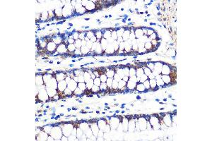 Immunohistochemistry of paraffin-embedded human colon using TFAM Rabbit mAb (ABIN3023684, ABIN3023685, ABIN3023686, ABIN1680049 and ABIN1680050) at dilution of 1:100 (40x lens). (TFAM antibody)