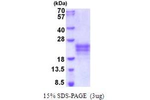 Interleukin 9 (IL9) (AA 19-144) protein (His tag)