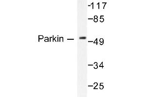 Image no. 1 for anti-Parkinson Protein 2, E3 Ubiquitin Protein Ligase (Parkin) (PARK2) antibody (ABIN271775) (Parkin antibody)