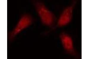 ABIN6276417 staining  HeLa cells by IF/ICC. (JUP antibody  (C-Term))