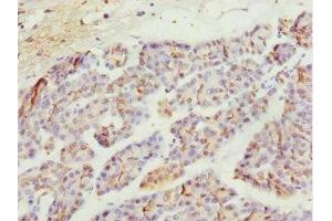 Immunohistochemistry of paraffin-embedded human pancreatic tissue using ABIN7174959 at dilution of 1:100 (MYO5C antibody  (AA 270-420))