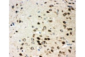 IHC-P: Integrin alpha 3 antibody testing of rat brain tissue (ITGA3 antibody  (N-Term))
