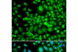Immunofluorescence analysis of MCF-7 cells using SETD5 Polyclonal Antibody (SETD5 antibody)